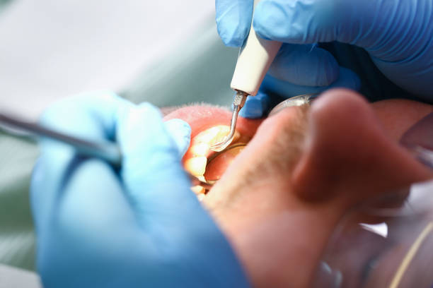 Best Emergency Denture Repair in Forsyth, IL